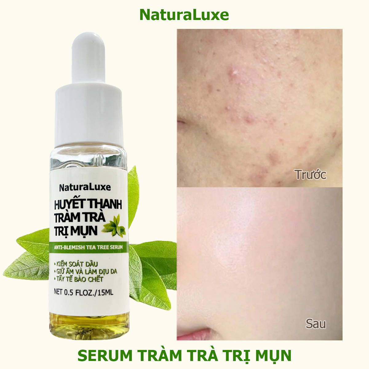 Huyết Thanh Tràm Trà Trị Mụn NaturaLuxe, Serum Tràm Trà Trị Mụn NaturaLuxe, giảm mụn, Giữ ẩm, Kiểm soát dầu